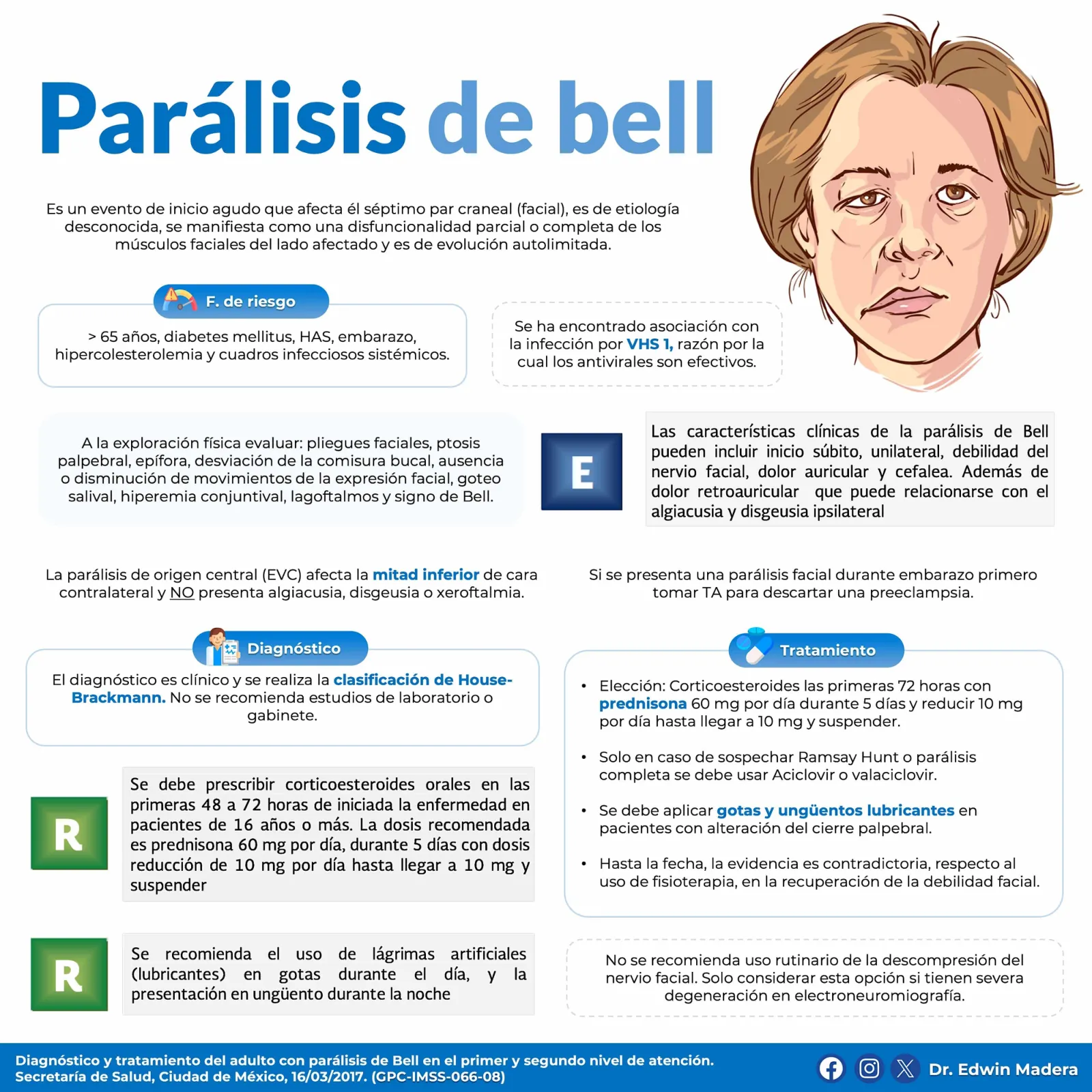Parálisis de Bell