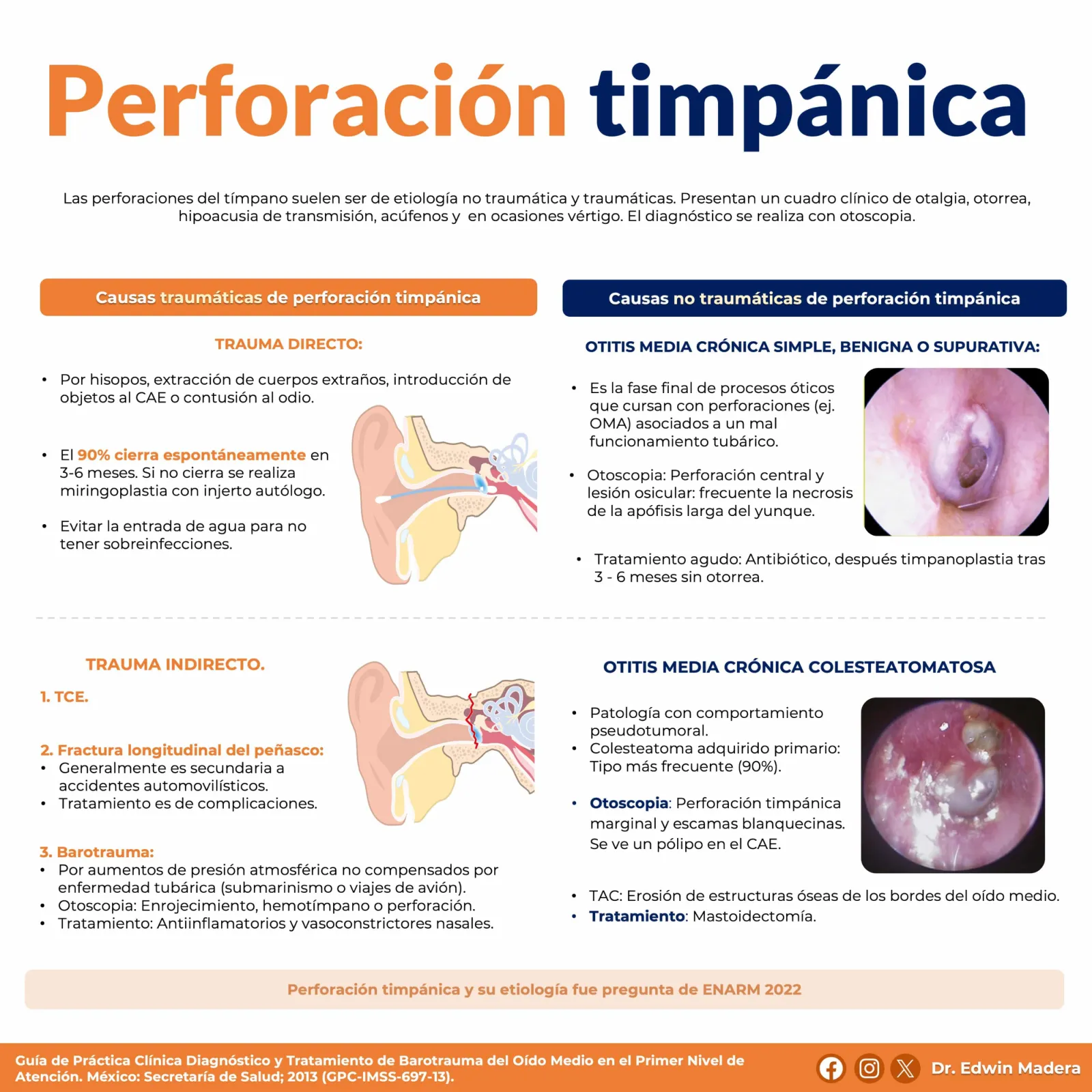 Perforación timpánica