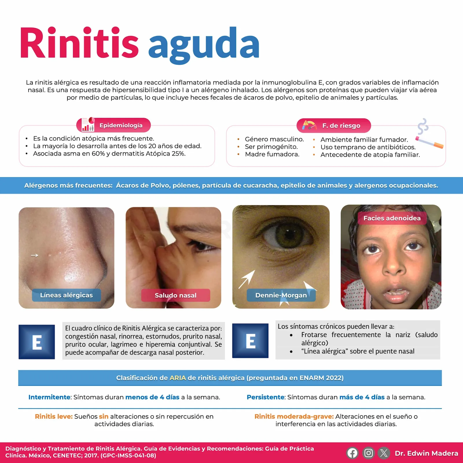 Rinitis aguda
