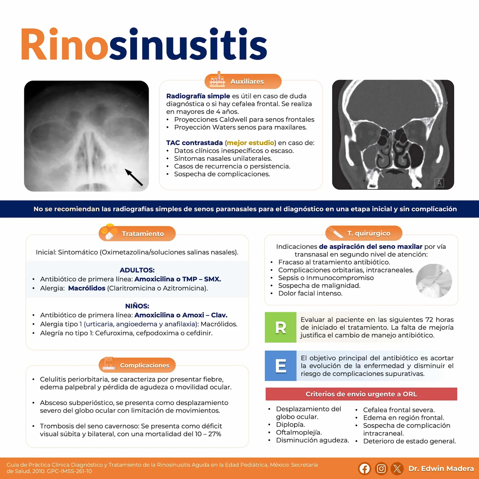 Rinosinusitis