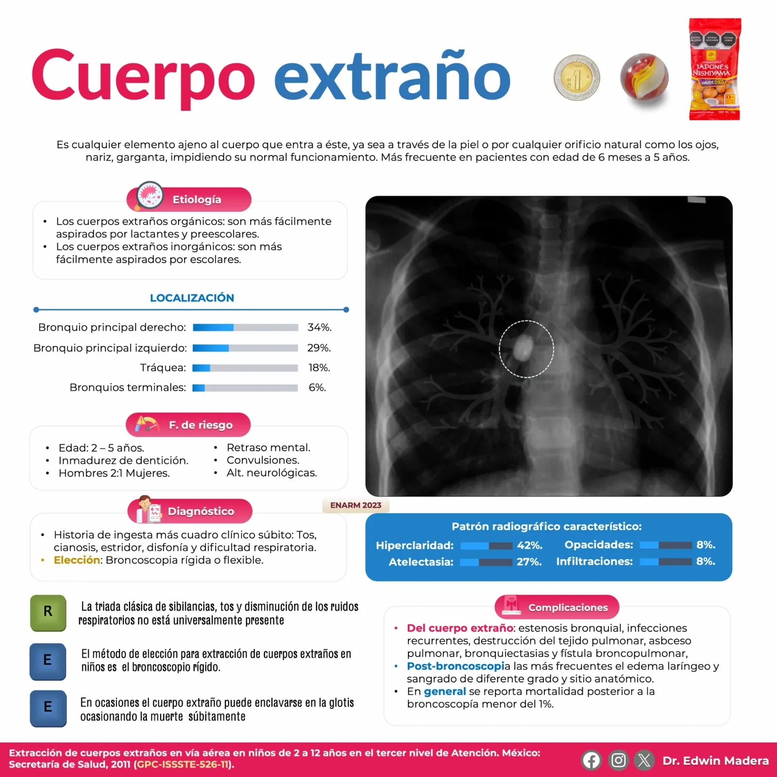 Cuerpo extraño