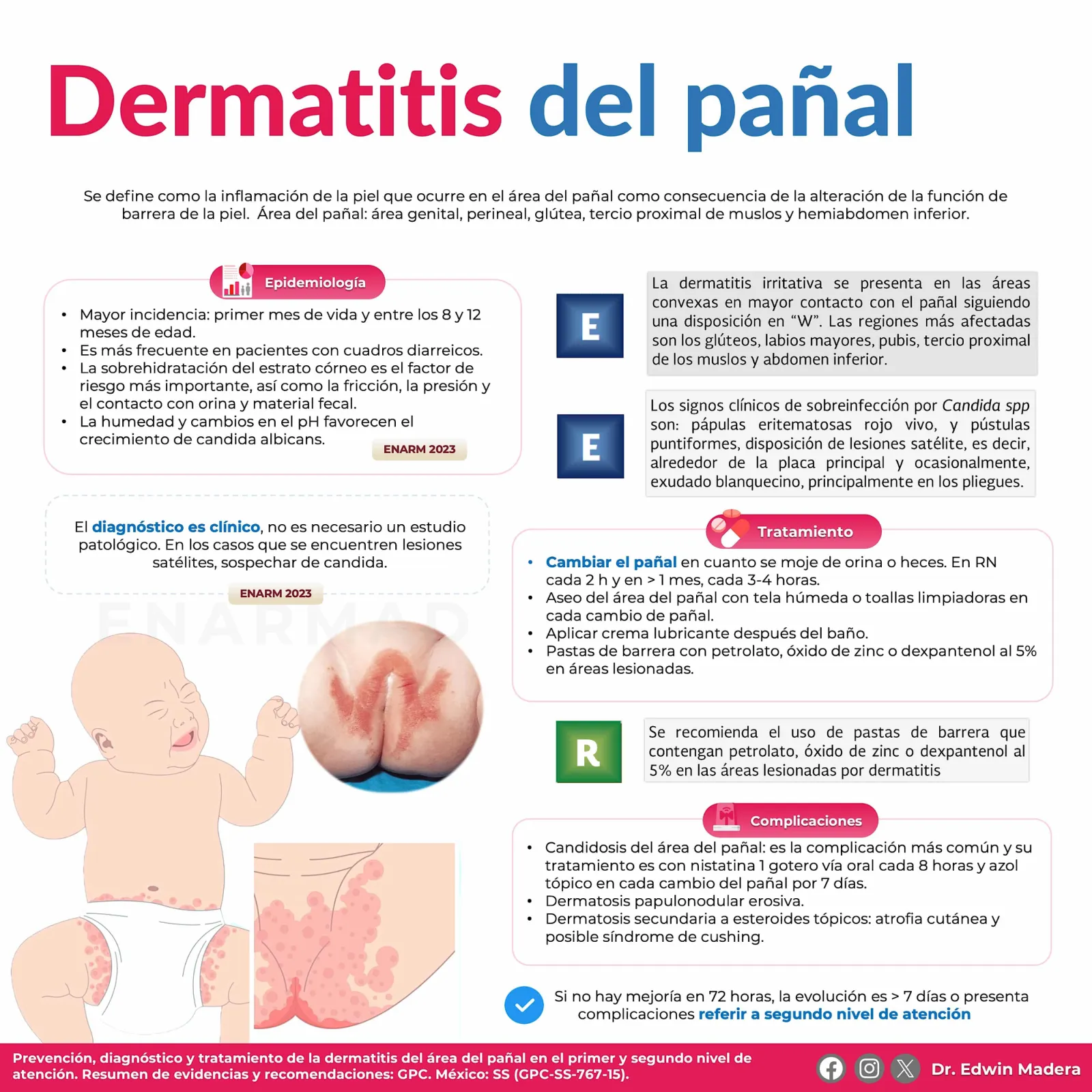 Dermatitis del pañal