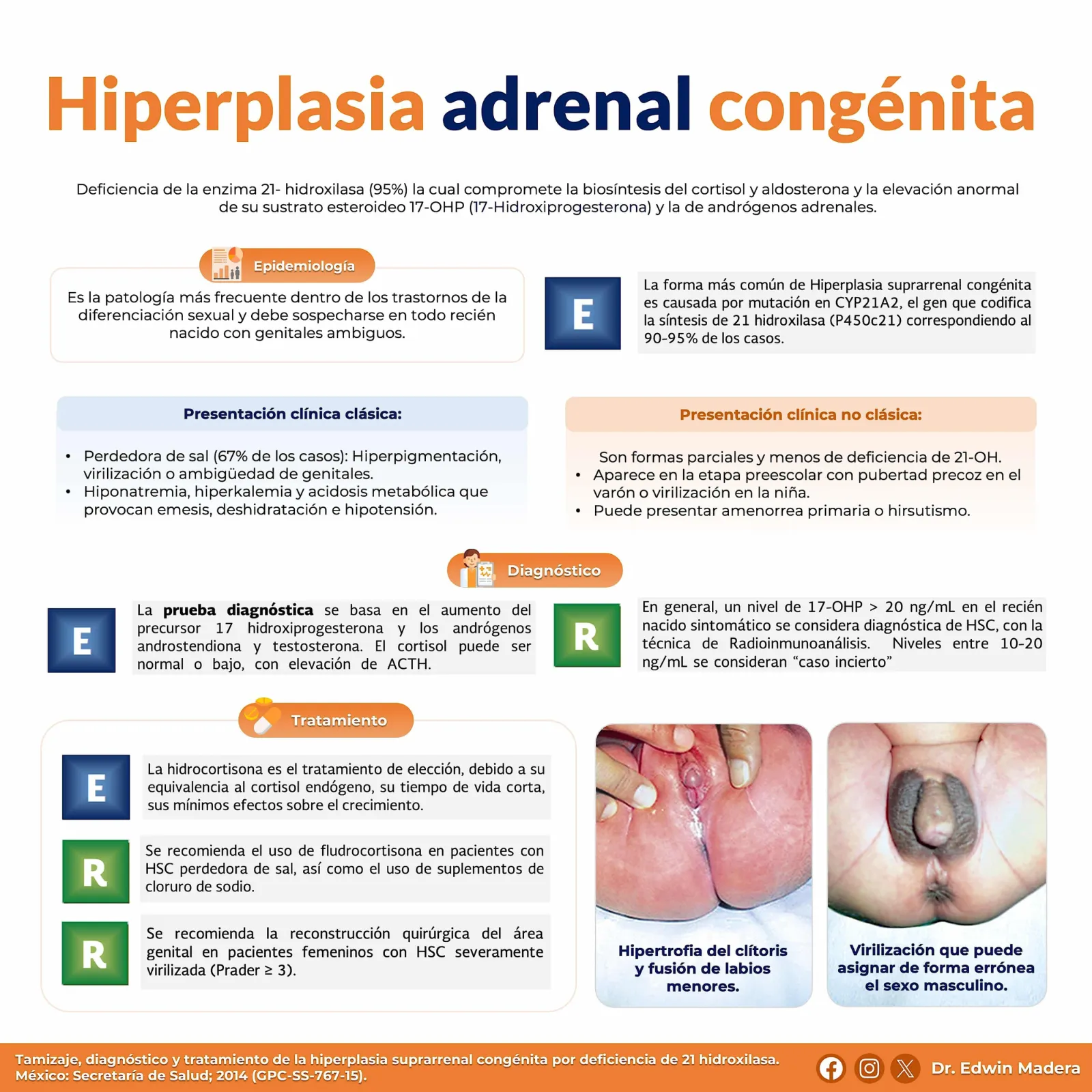 Hiperplasia adrenal congénita