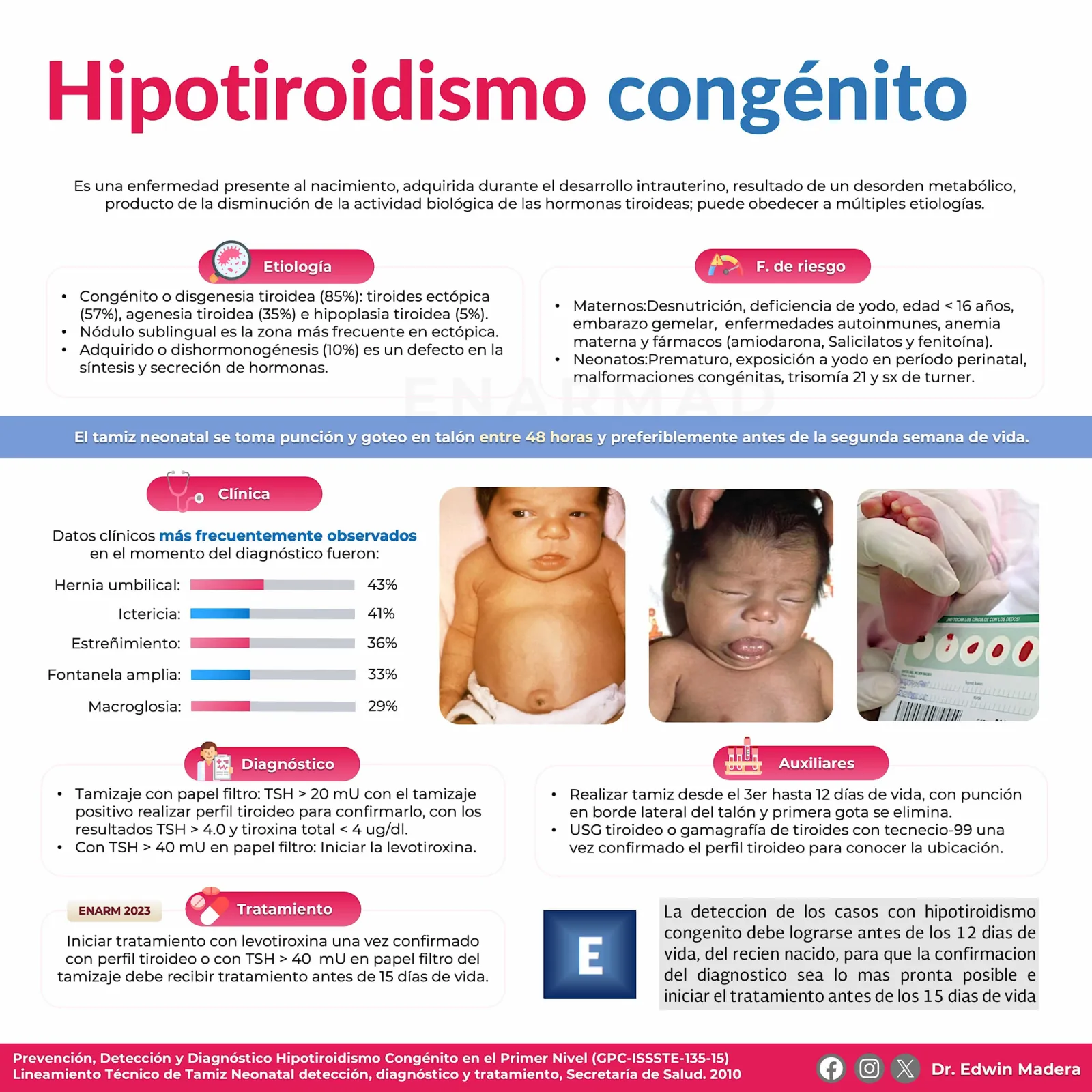 Hipotiroidismo congénito