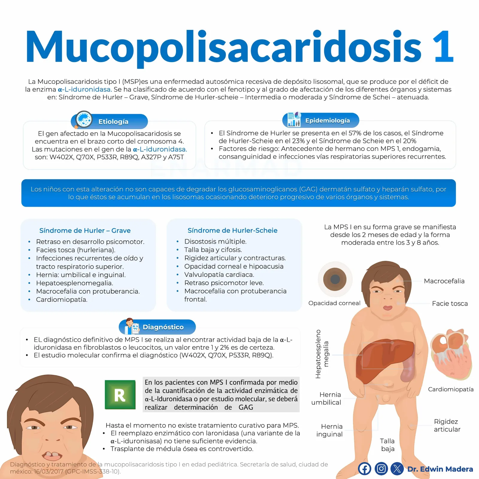 Mucopolisacaridosis