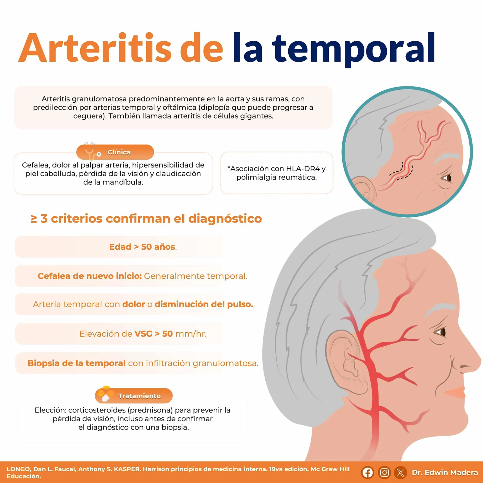 Arteritis de la temporal