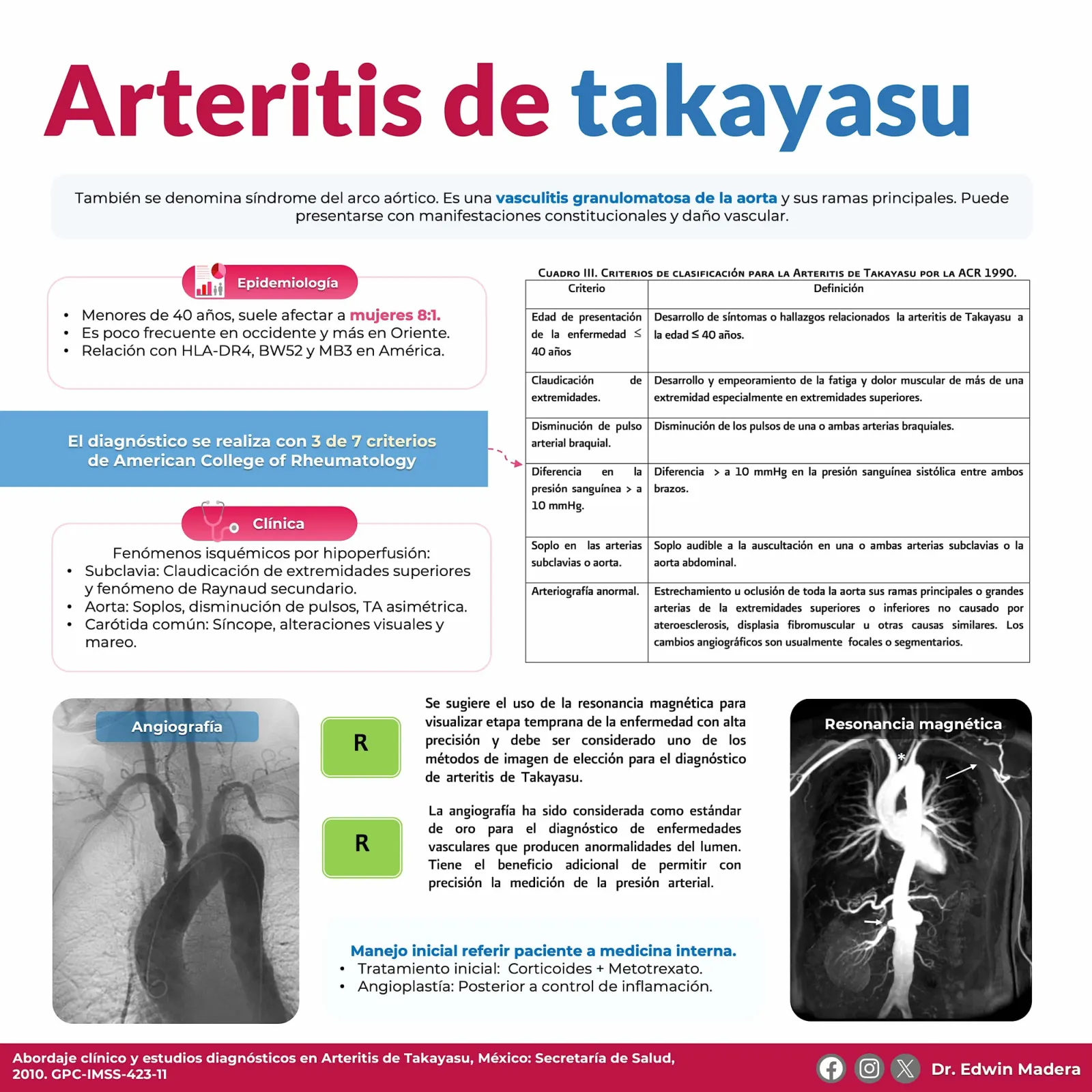 Arteritis de takayasu