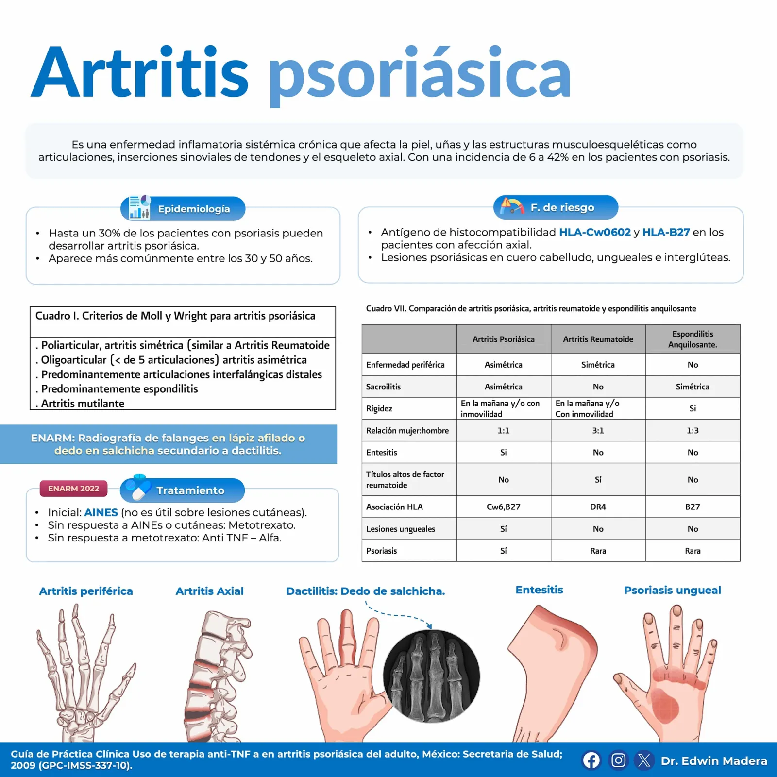 Artritis psoriásica