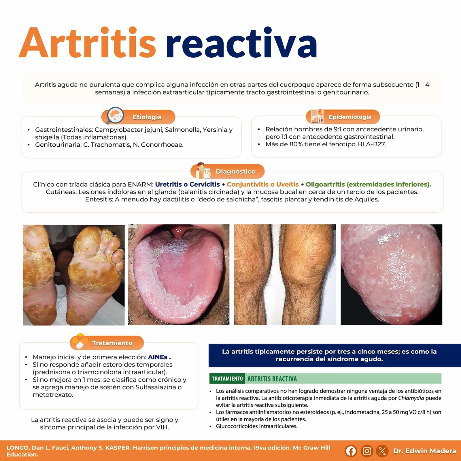 Artritis reactiva
