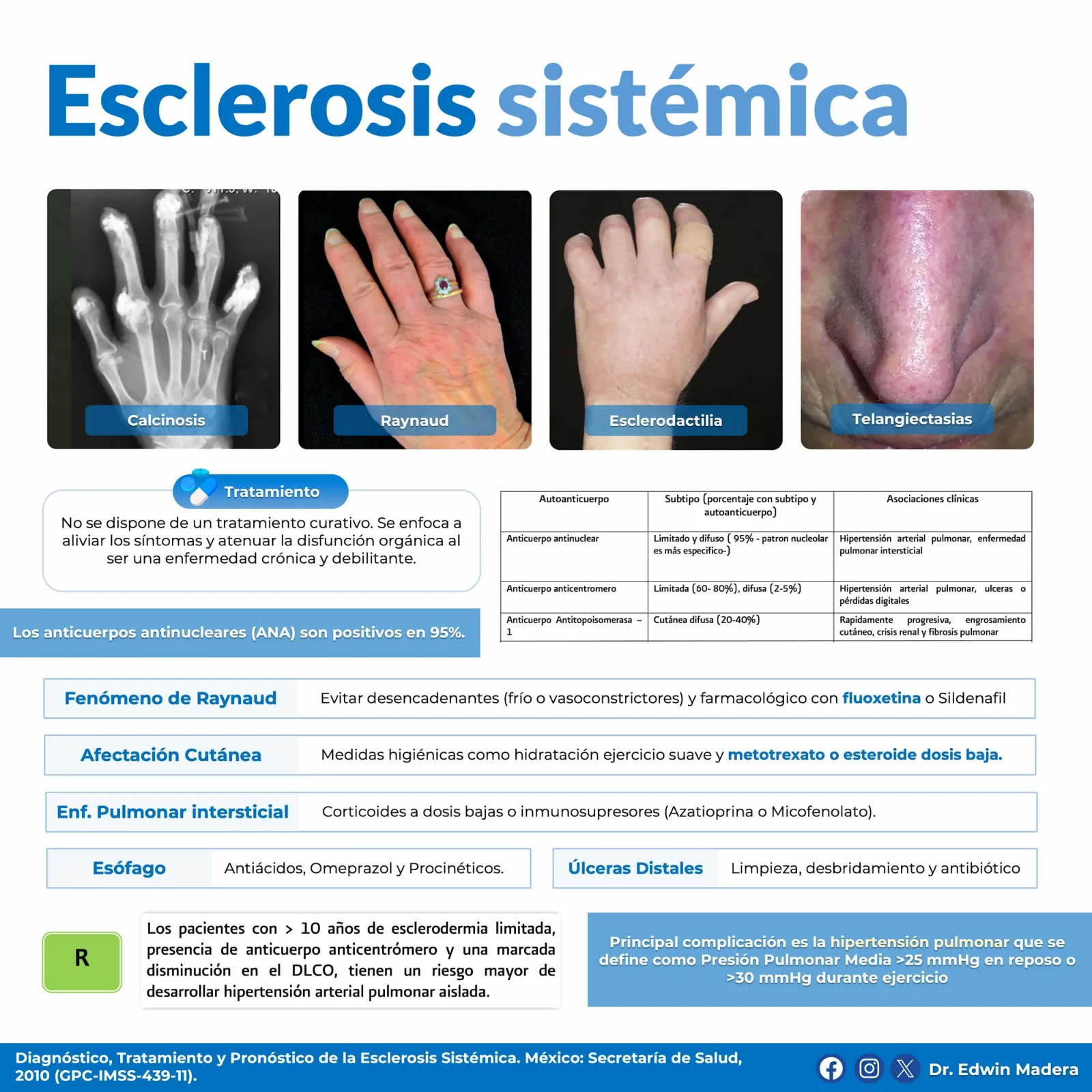 Esclerosis sistémica