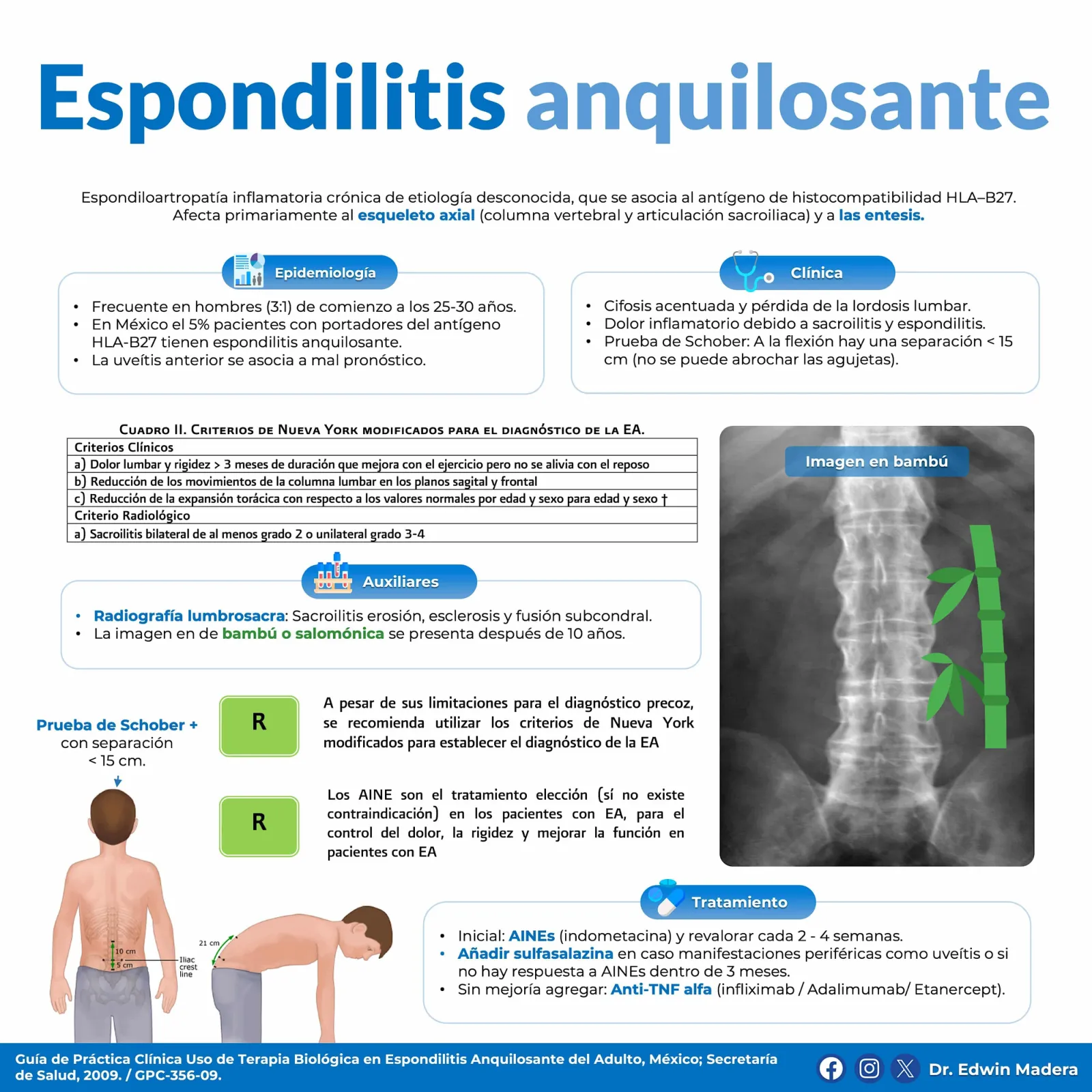 Espondilitis anquilosante