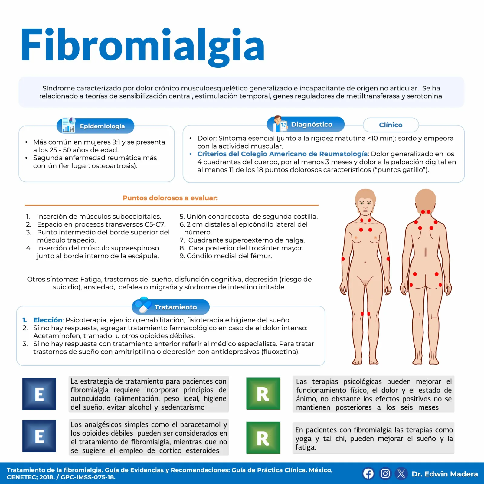 Fibromialgia