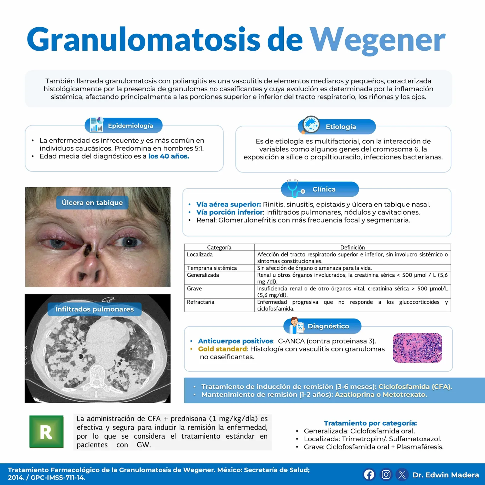 Granulomatosis de Wegener