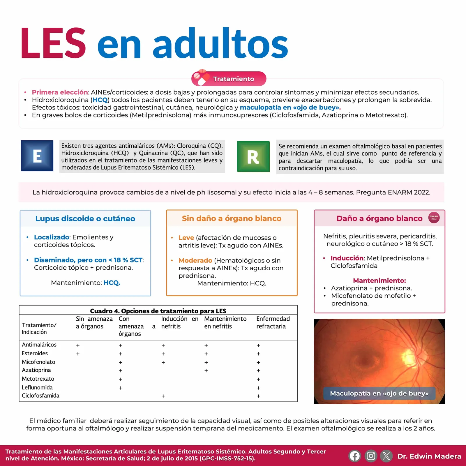Lupus eritematoso sistémico