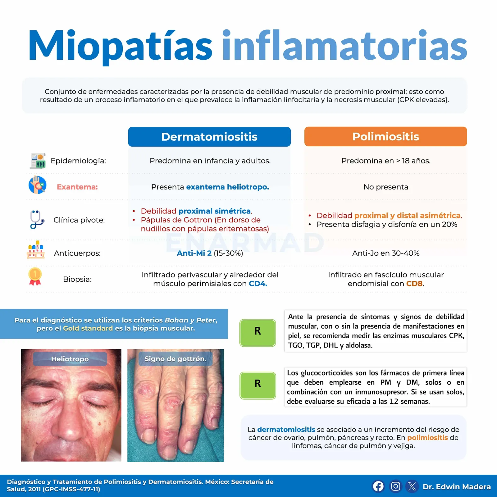 Miopatías inflamatorias