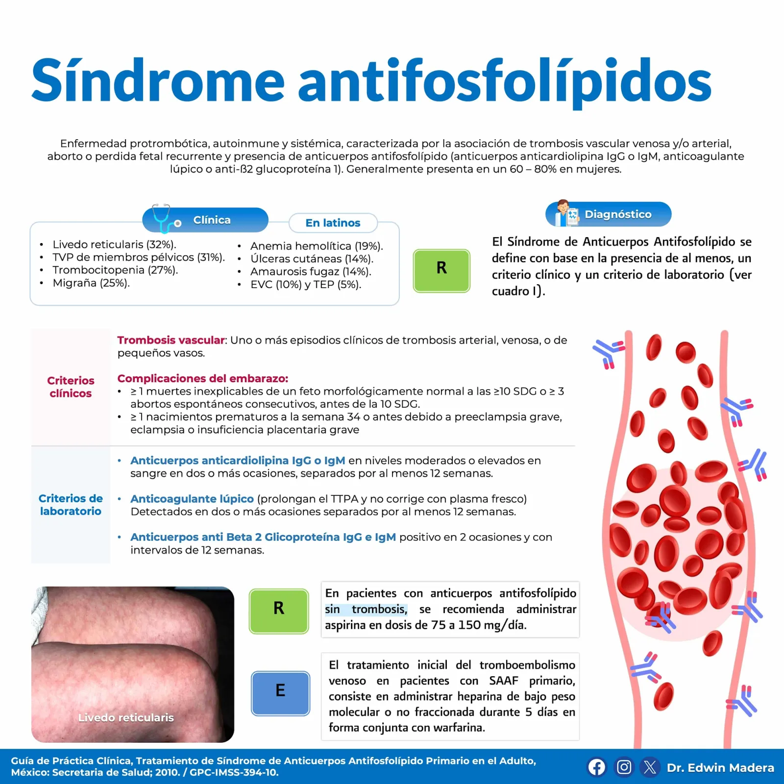 Síndrome antifosfolípidos