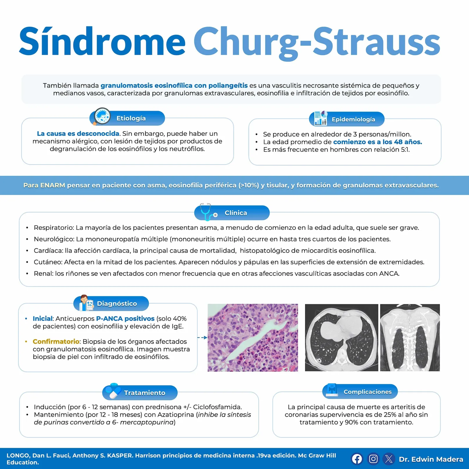 Síndrome de Churg-Strauss