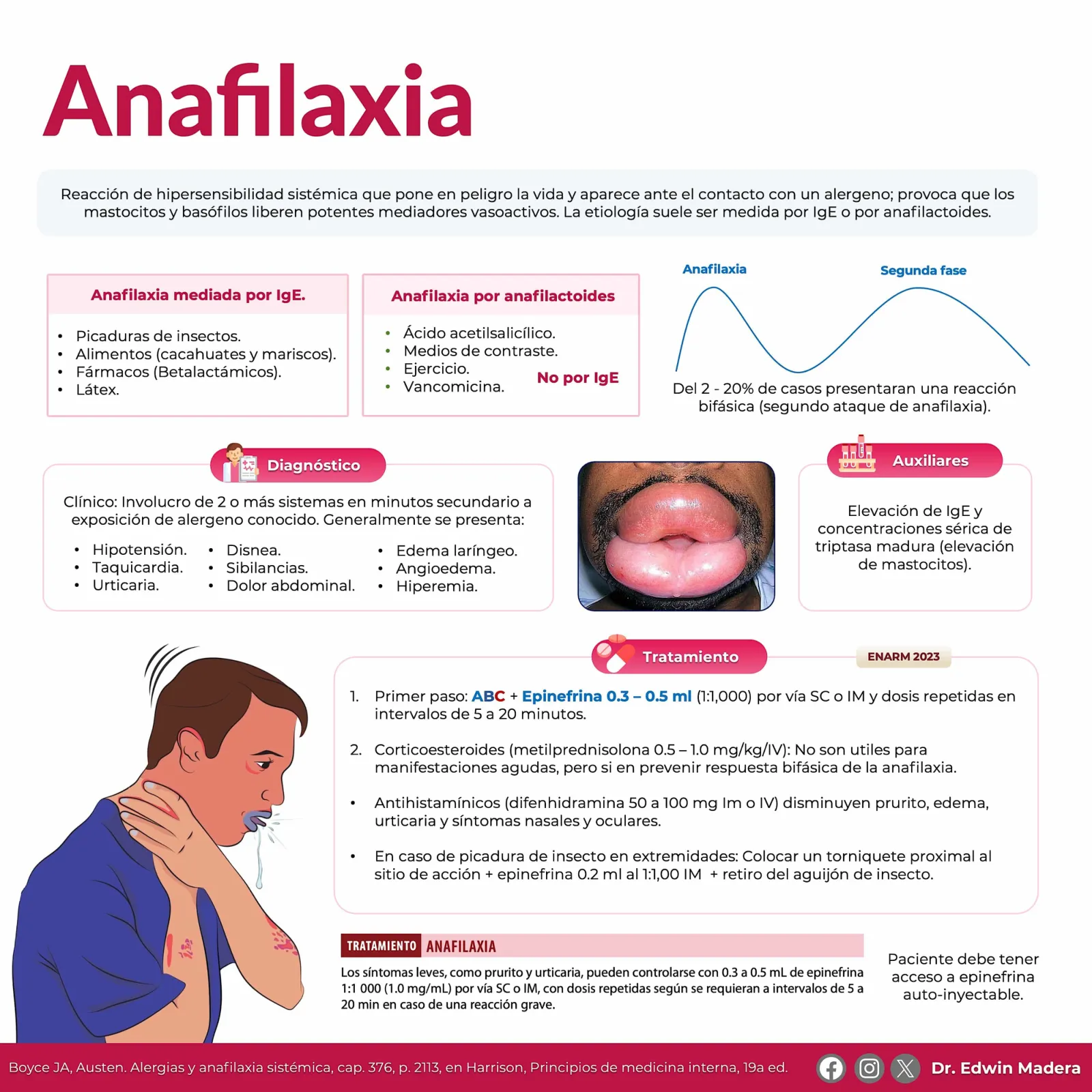 Anafilaxia