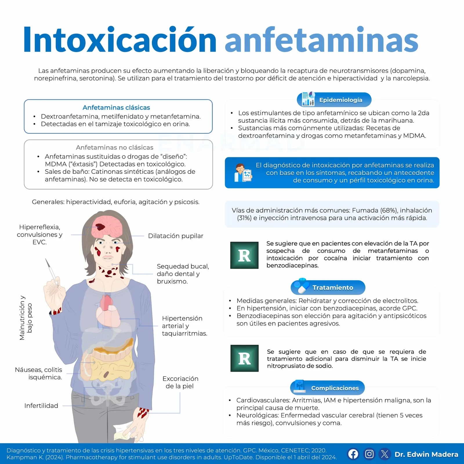 Intoxicación por anfetaminas