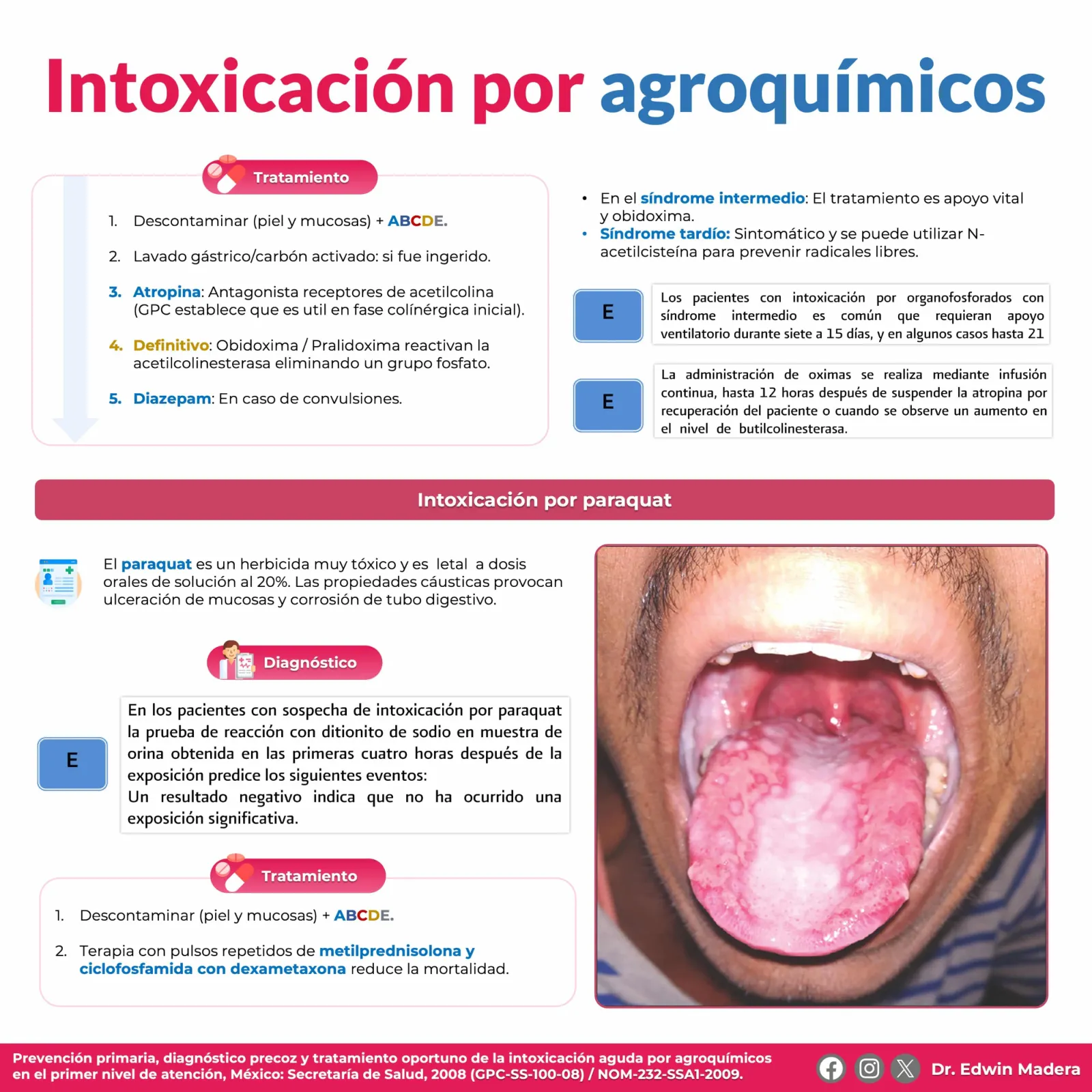 Intoxicación por organofosforados