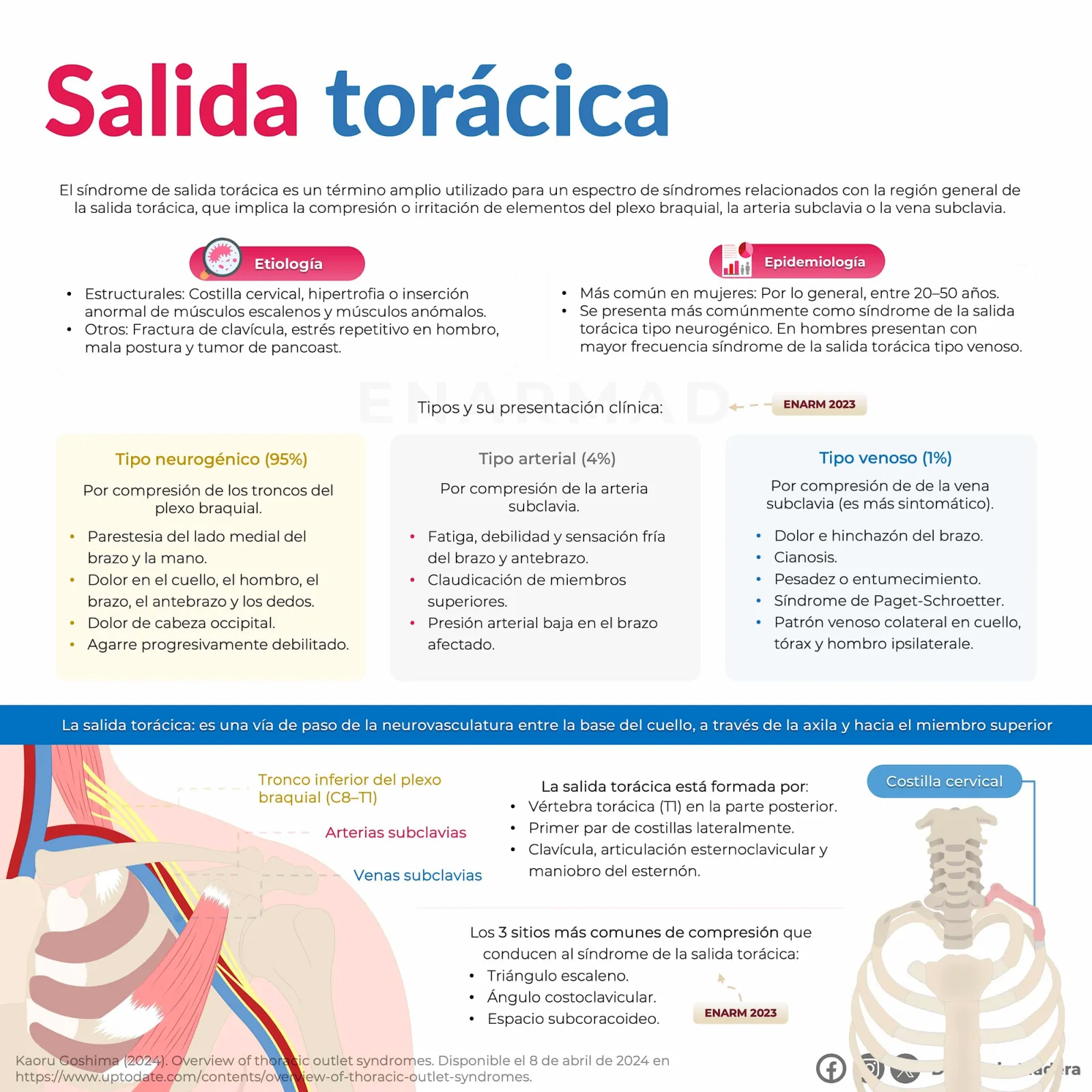 Costilla cervical