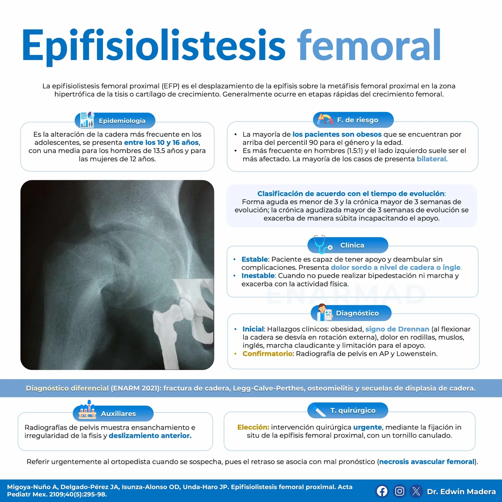 Epifisiolistesis femoral