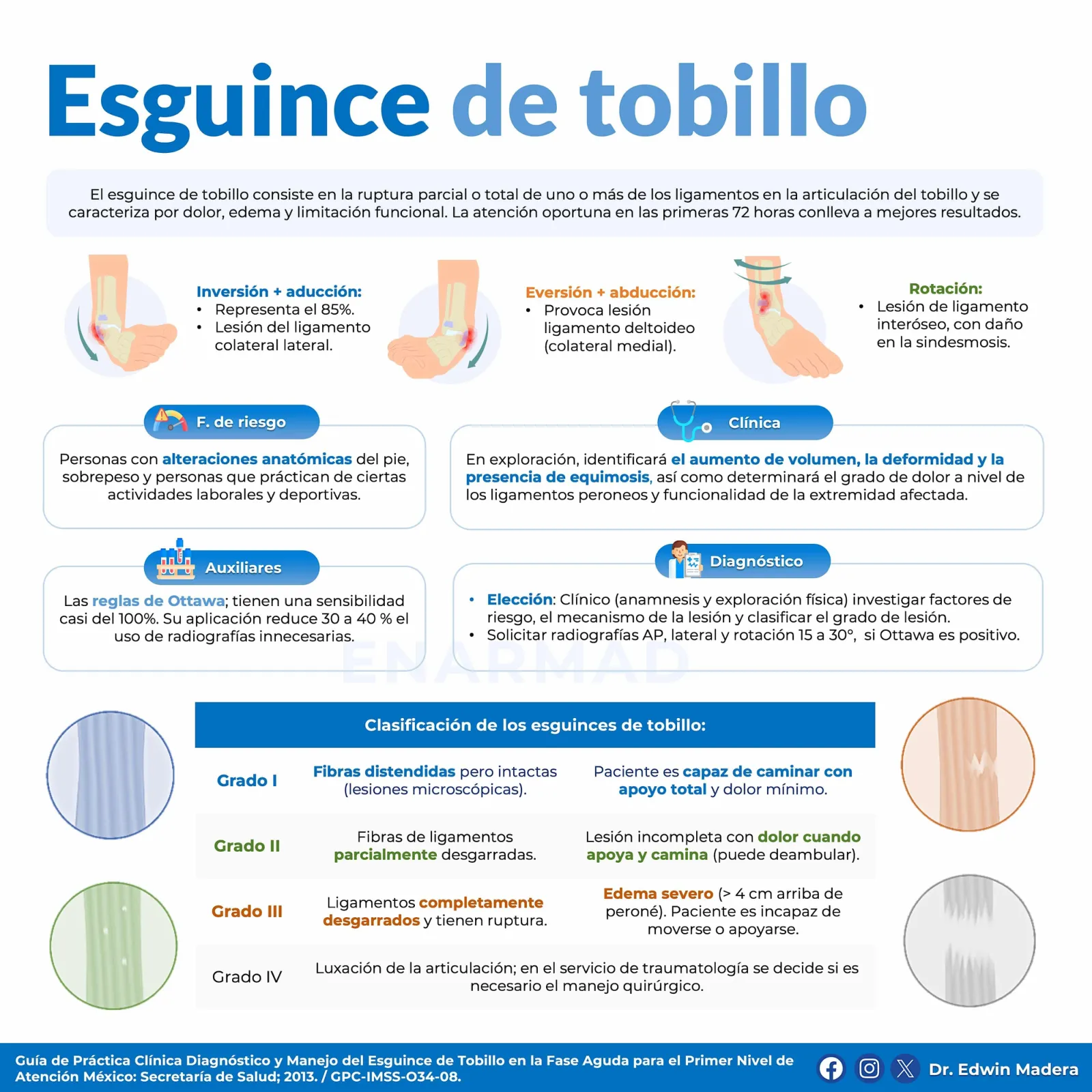 Esguince de tobillo