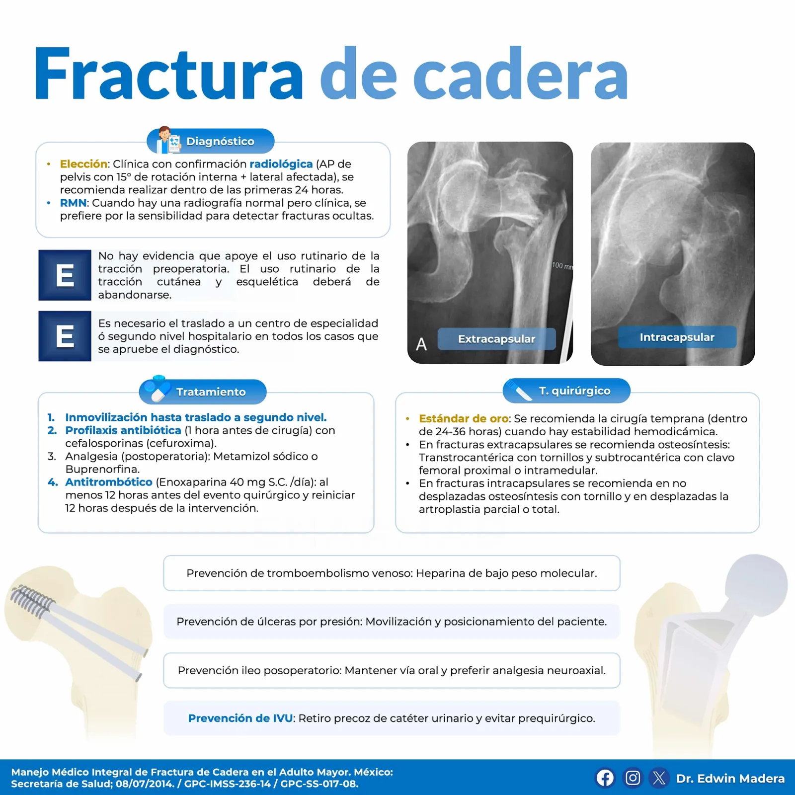 Fractura de cadera