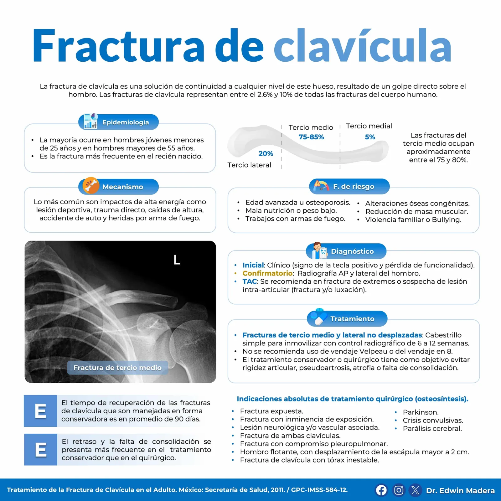 Fractura de clavícula