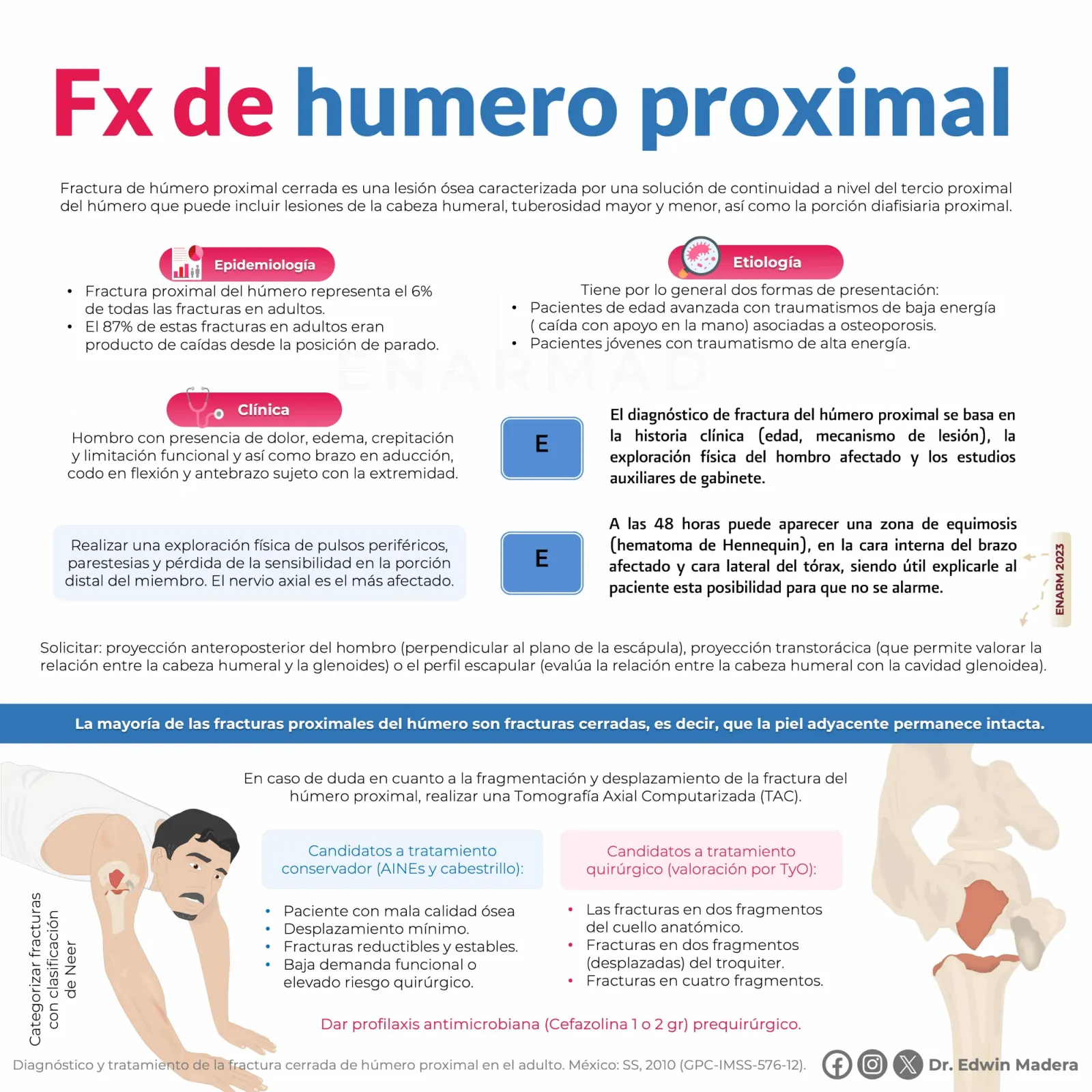 Fractura de humero proximal