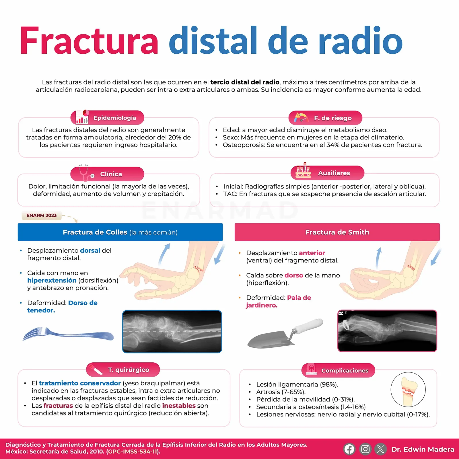 Fractura de radio distal