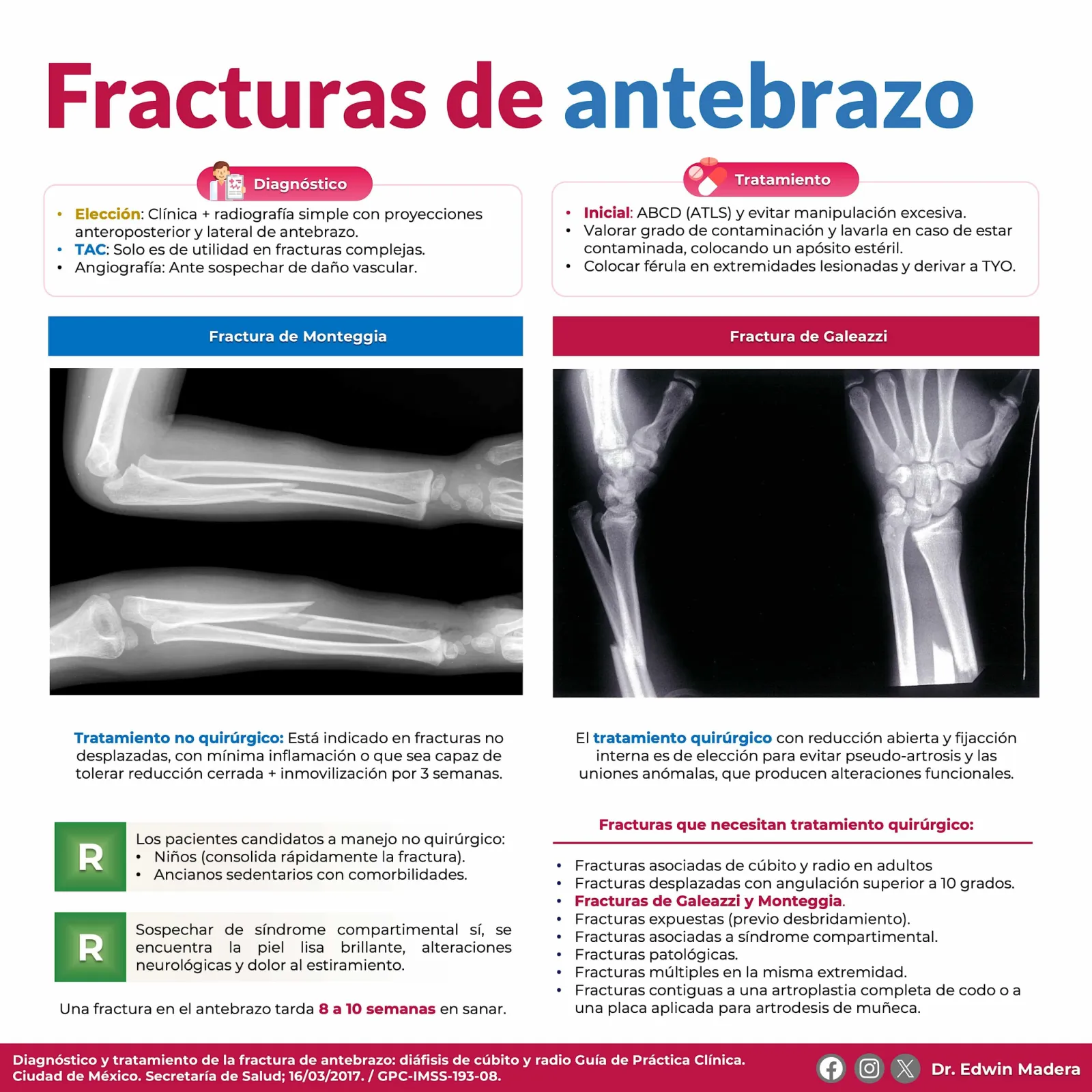 Fracturas de antebrazo