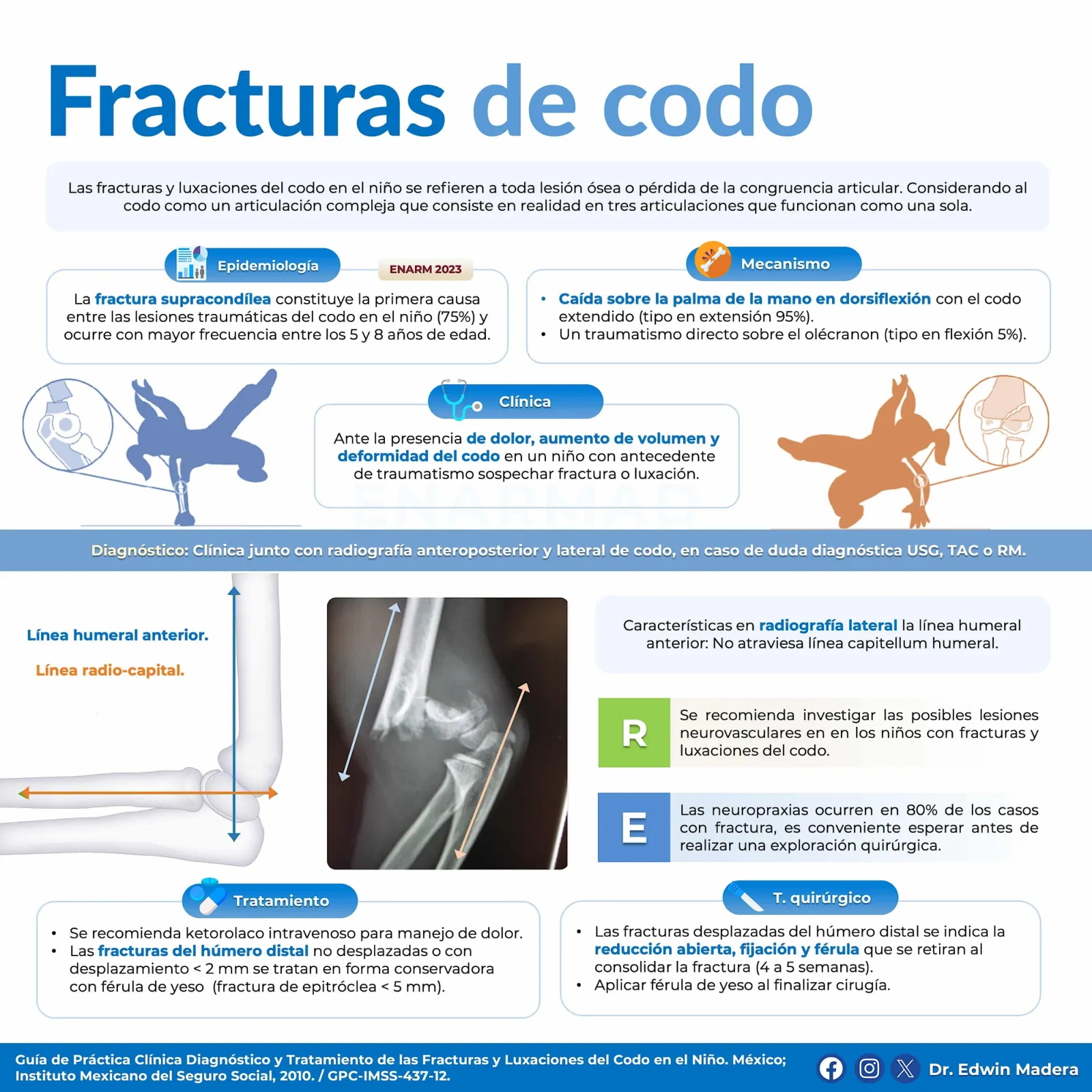 Fracturas de codo