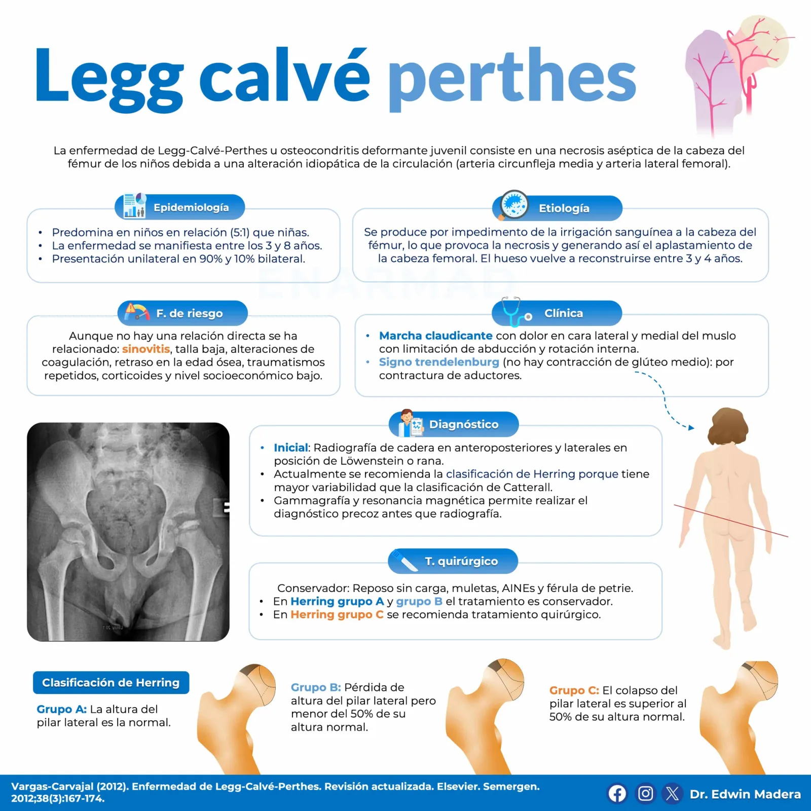 Legg calvé perthes