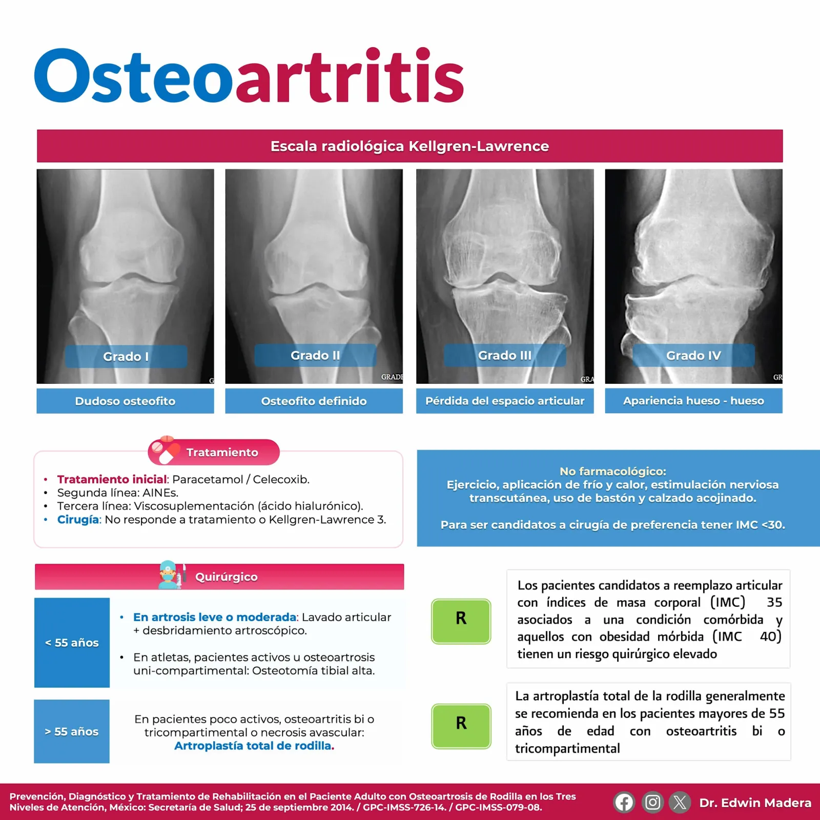 Osteoartritis