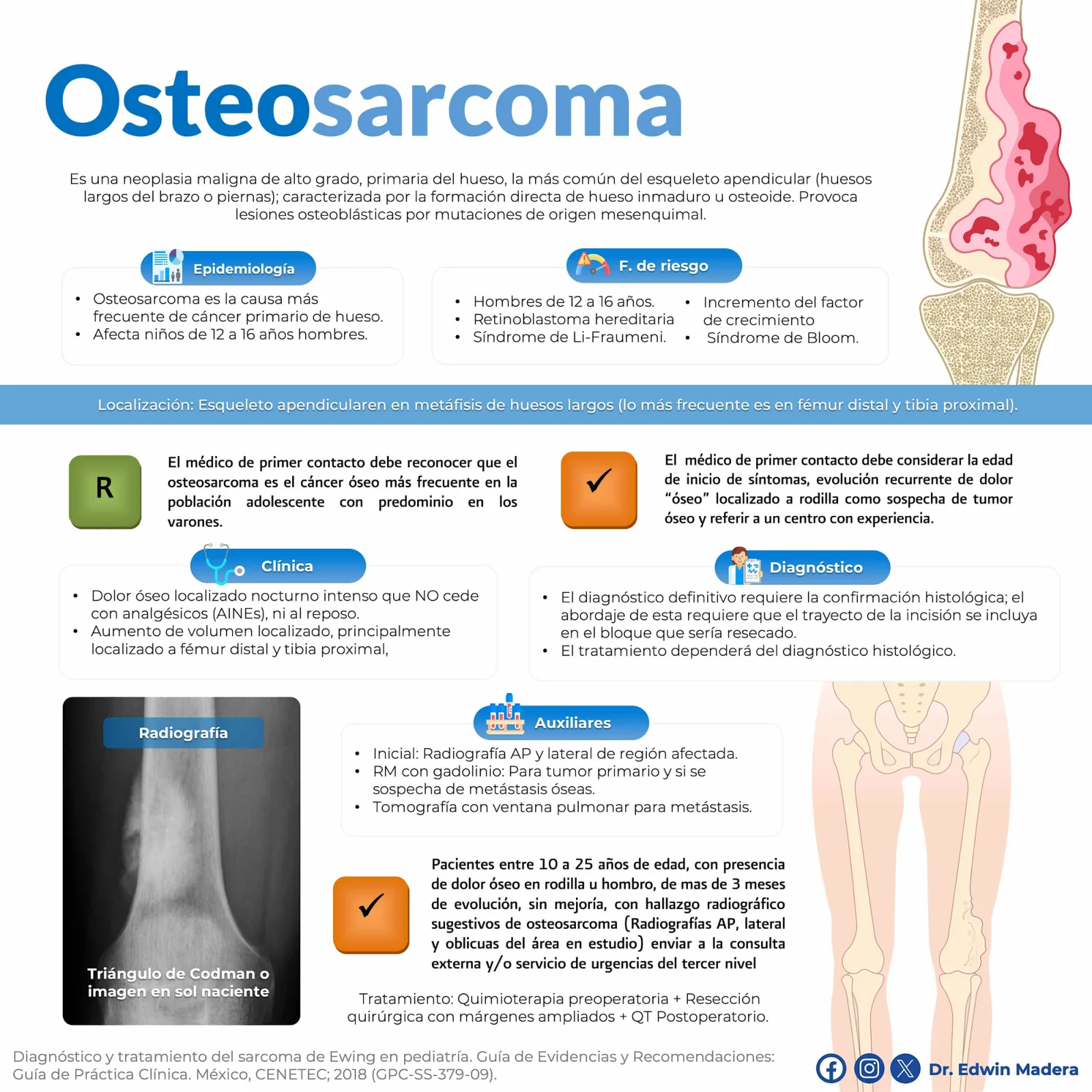 Osteosarcoma