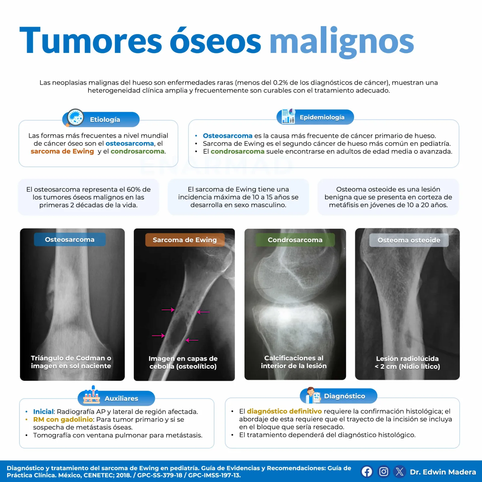 Tumores óseos malignos