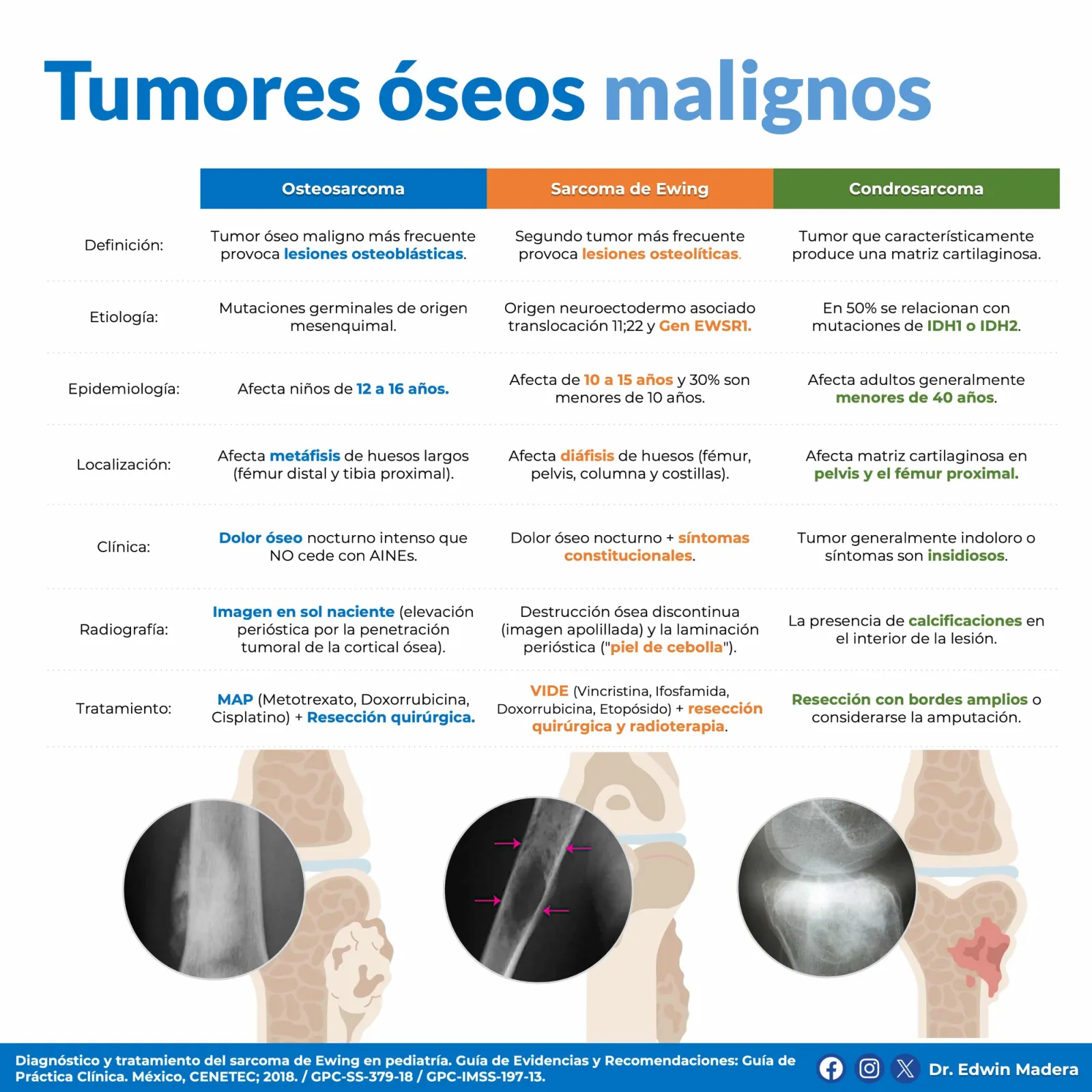 Tumores óseos malignos