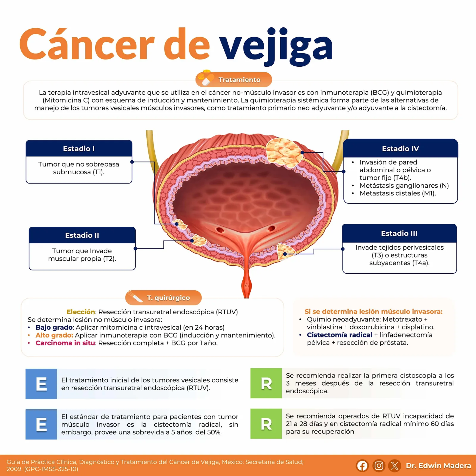 Cáncer de vejiga