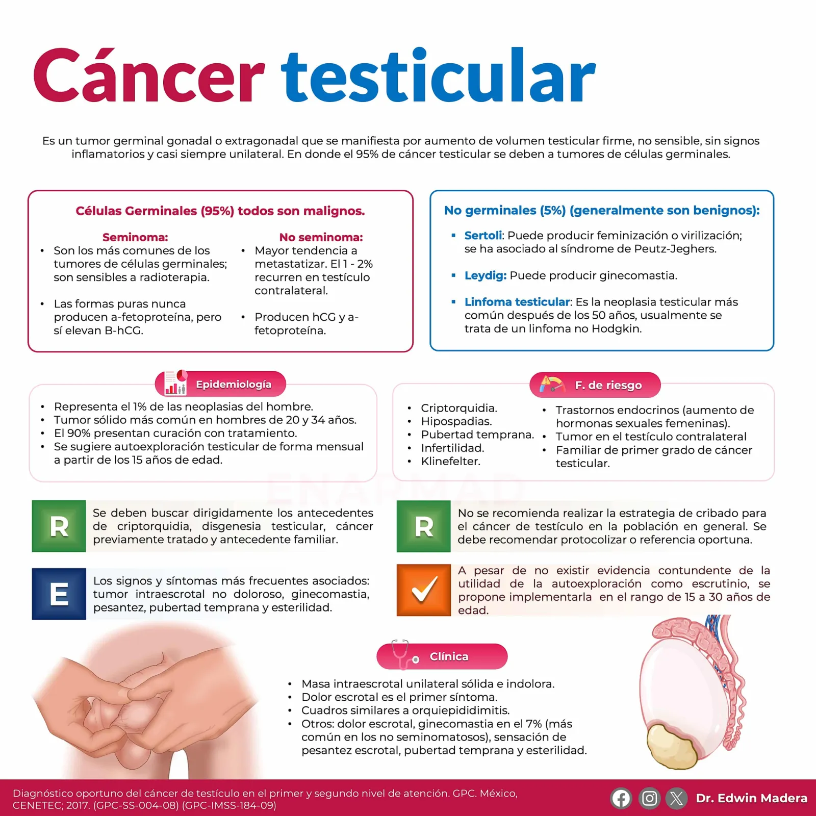 Cáncer testicular