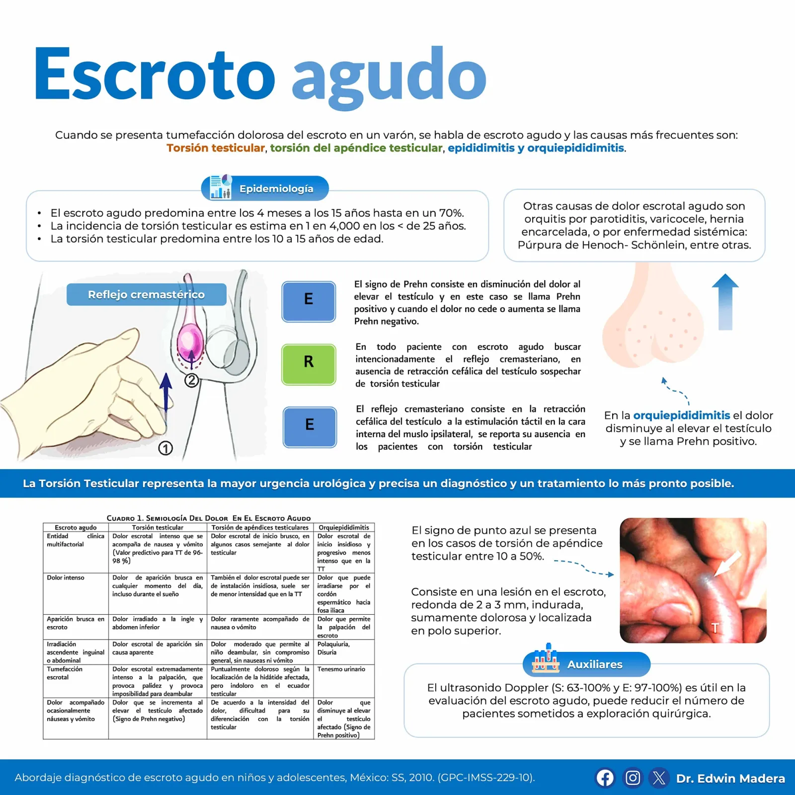 Escroto agudo