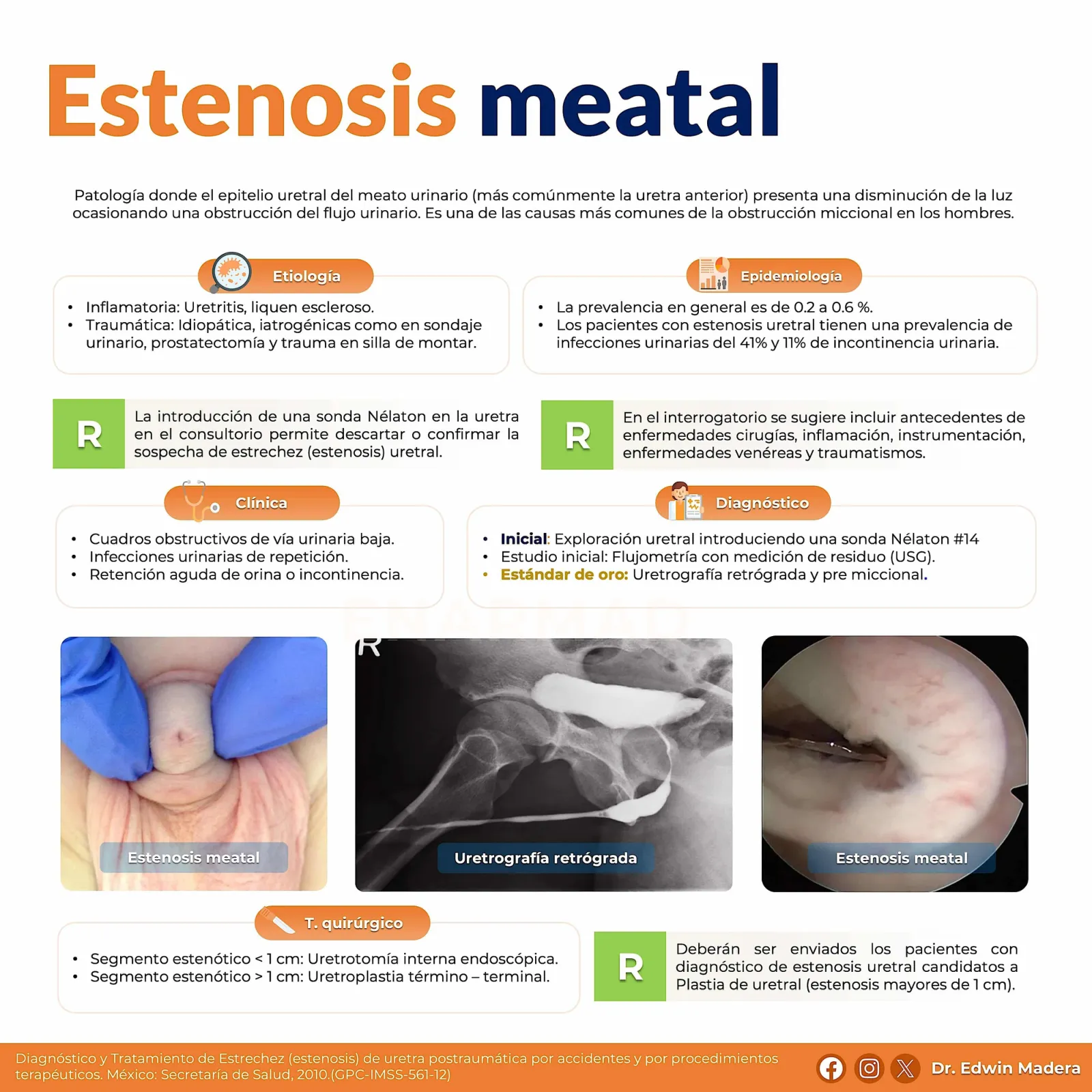 Estenosis del meato urinario