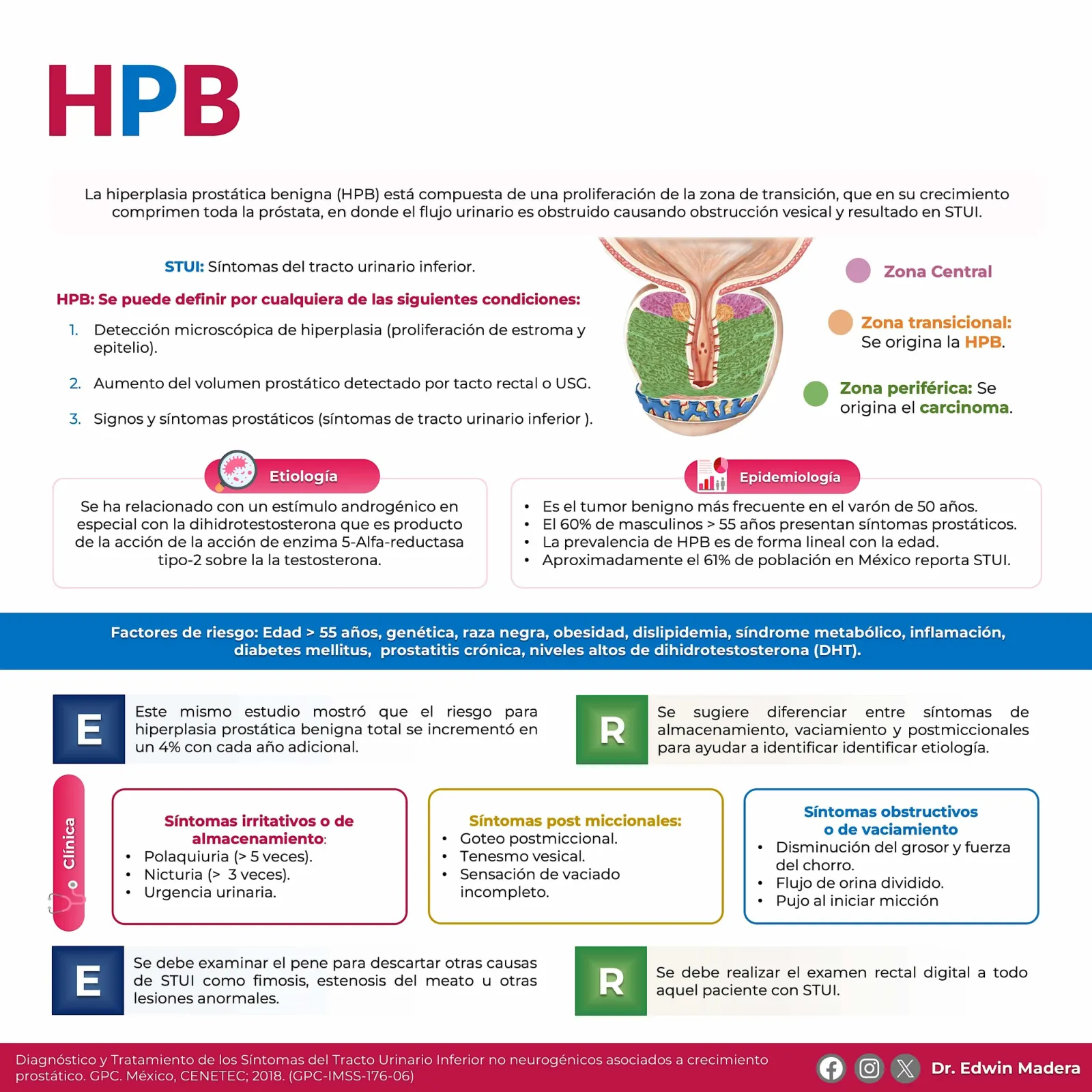 Hiperplasia prostática benigna