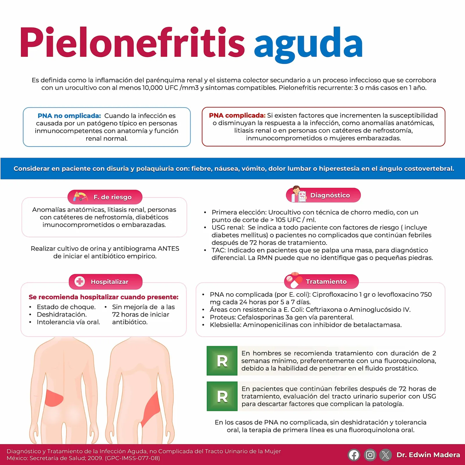 Pielonefritis aguda