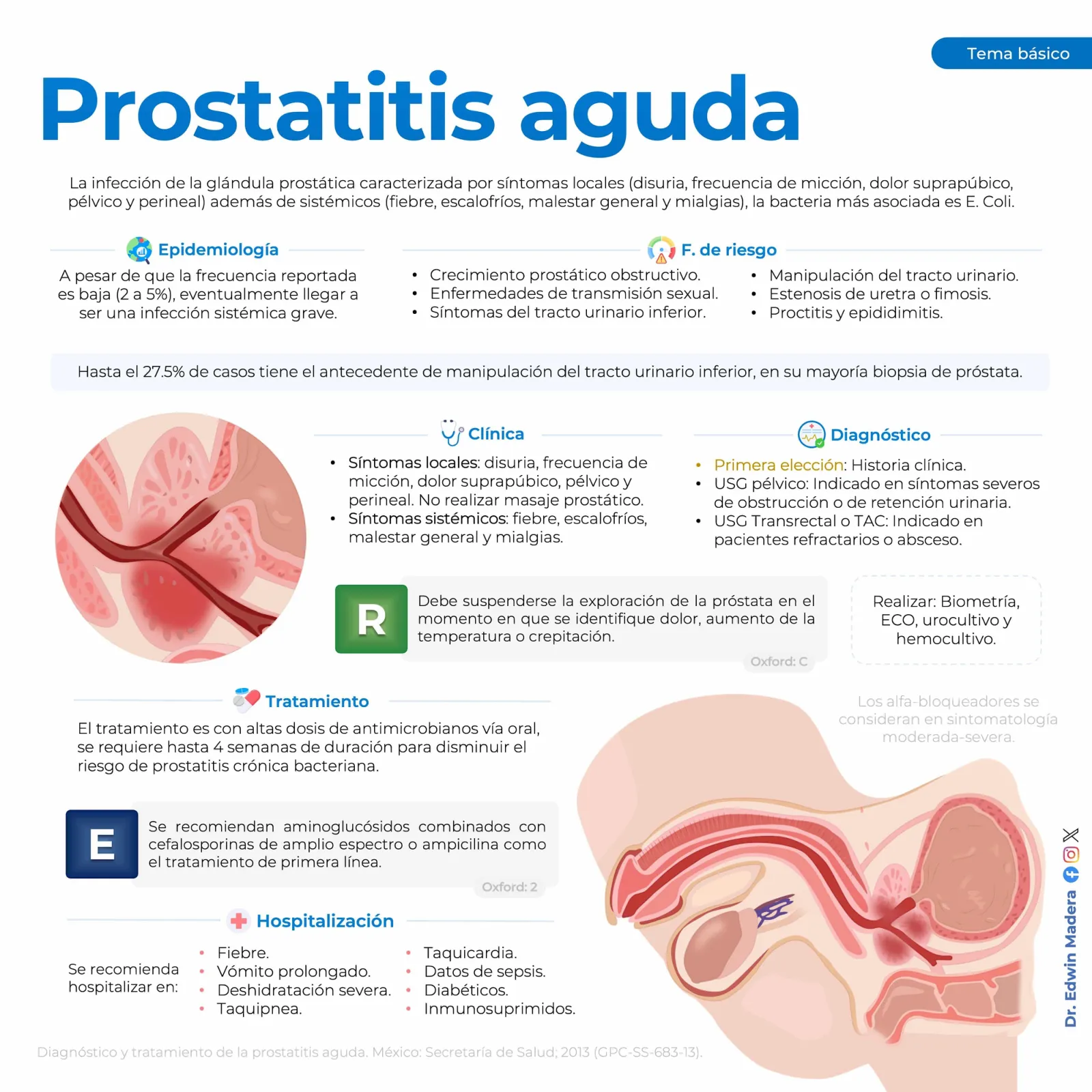 Prostatitis aguda