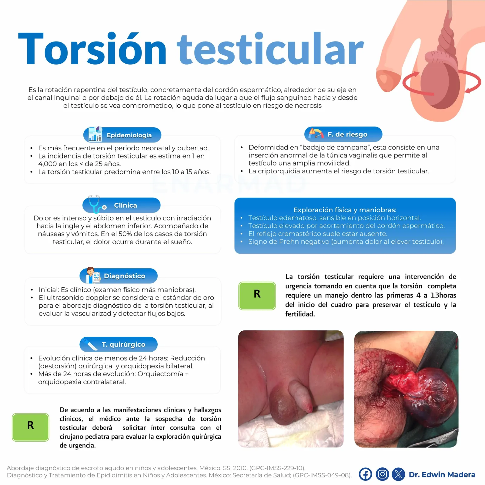 Torsión testicular