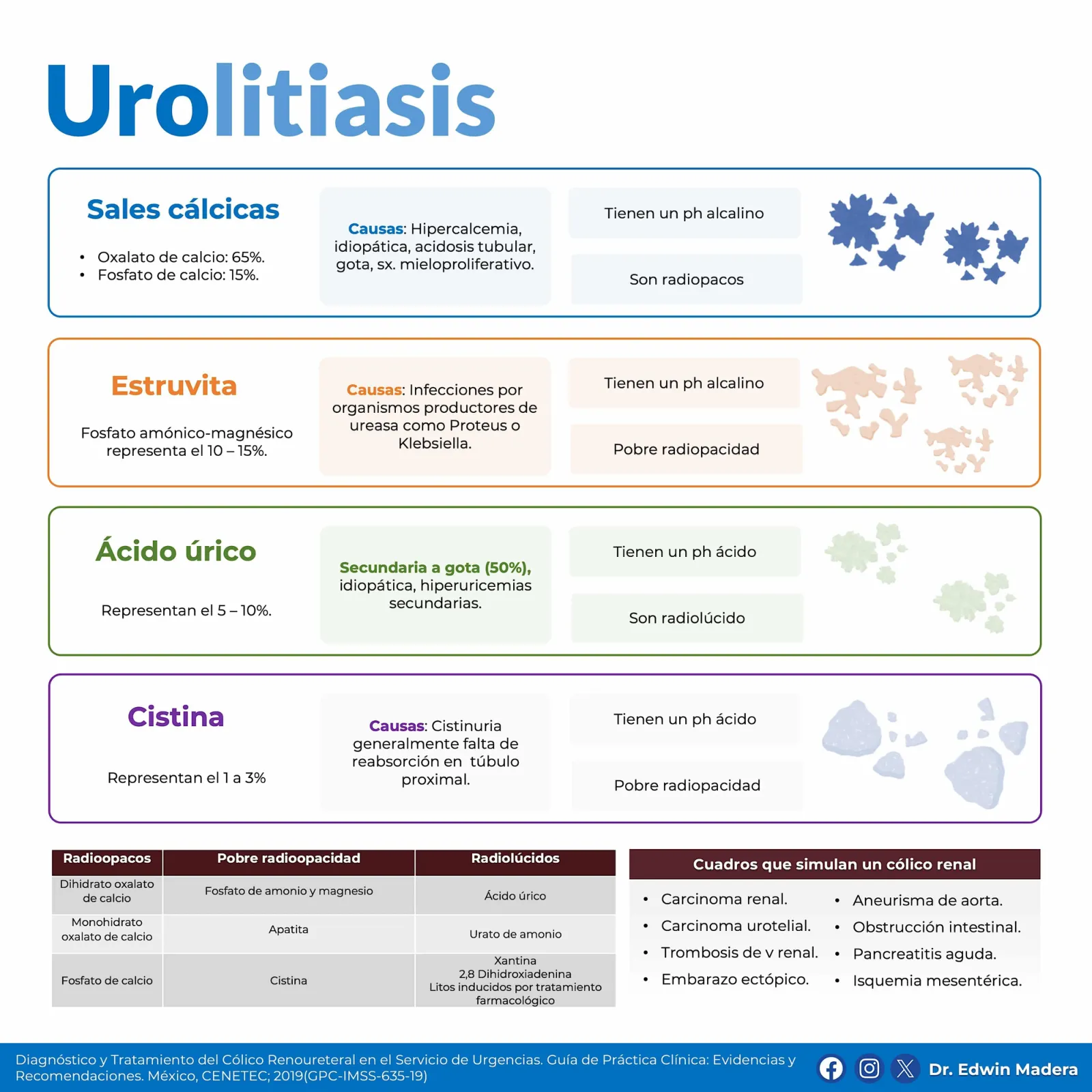 Urolitiasis