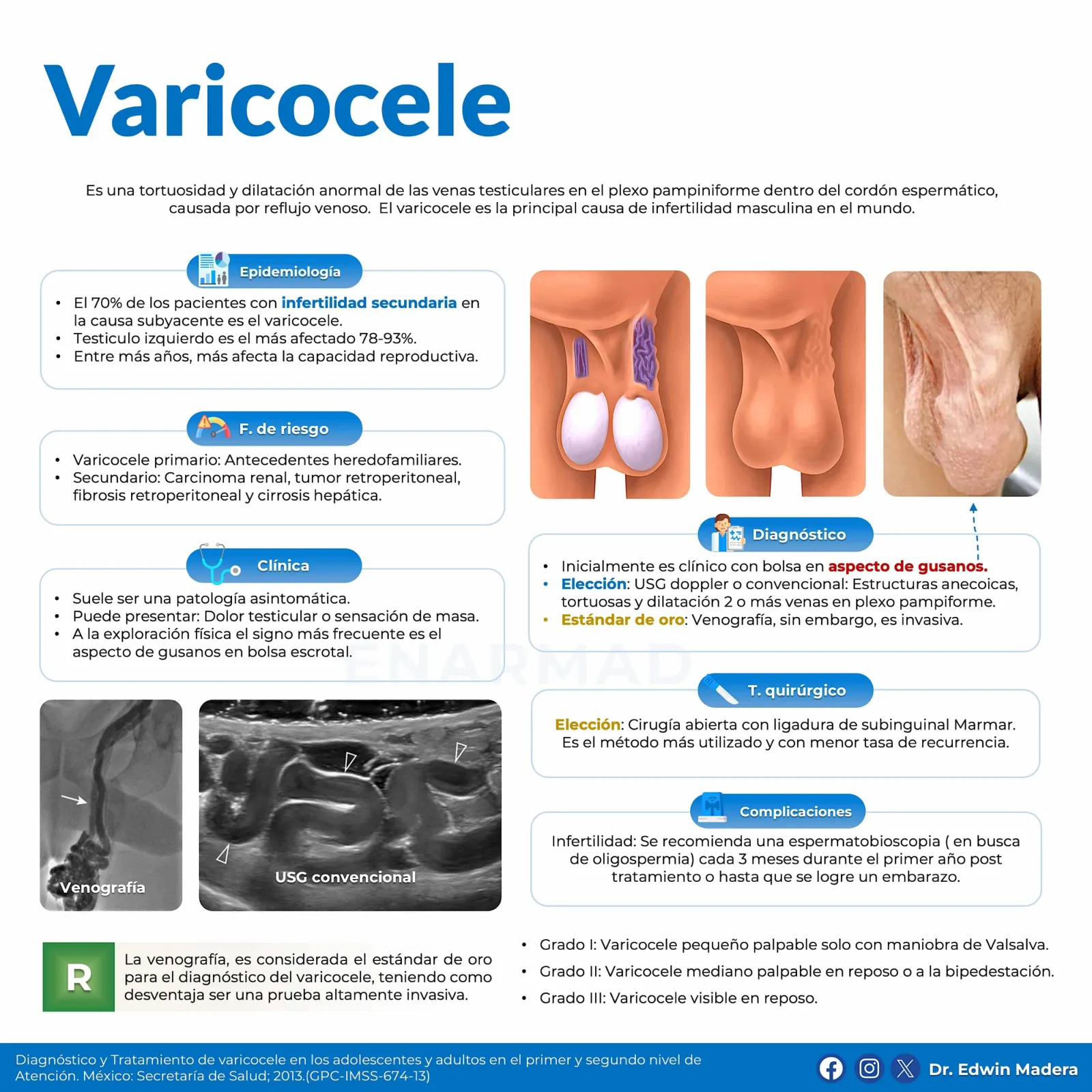 Varicocele