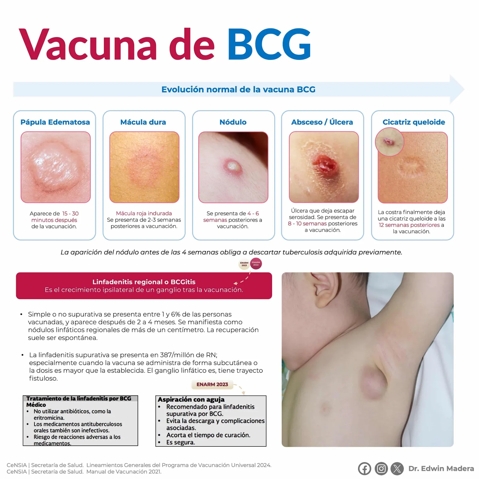 BCG